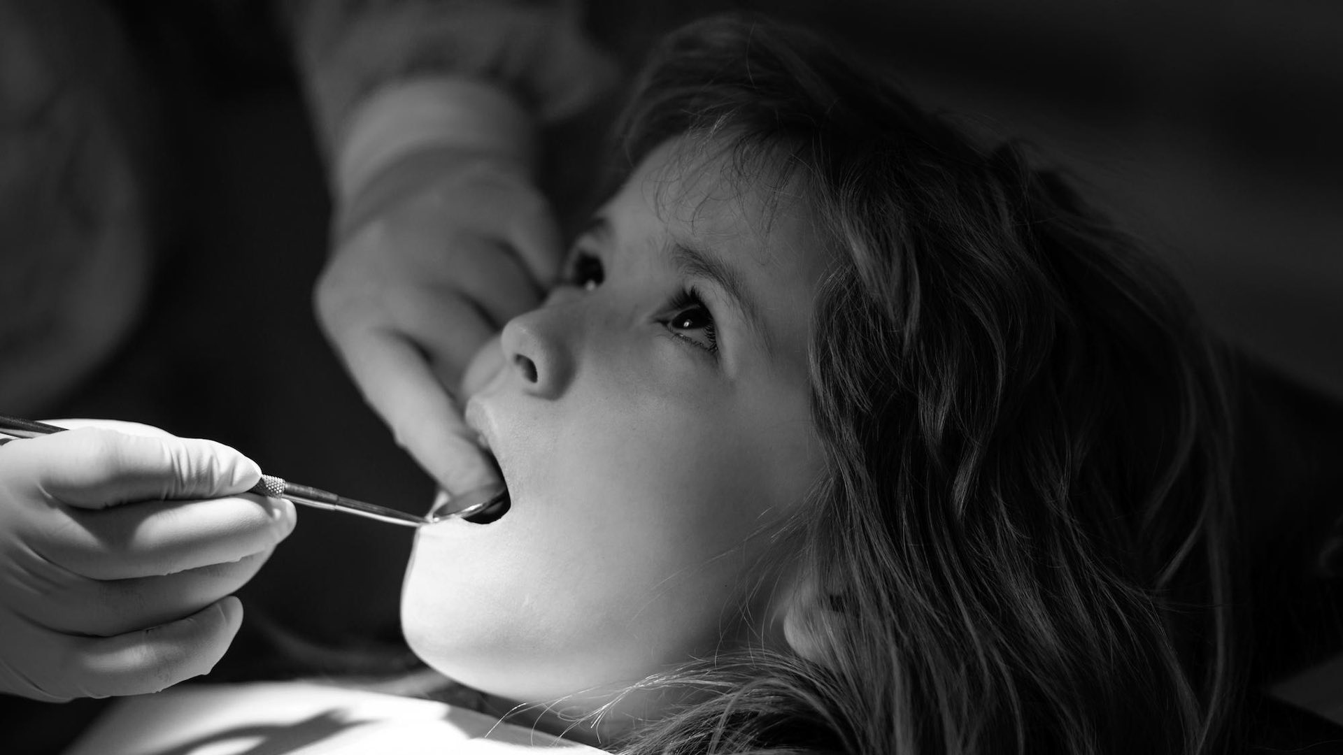 Silver diamine fluoride halts cavities in school program